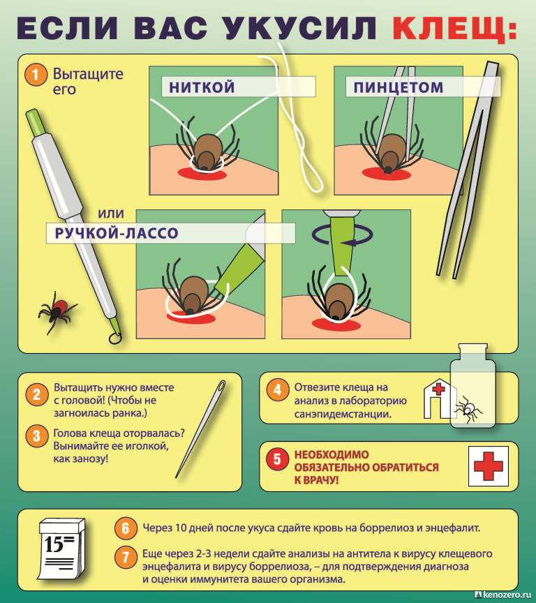 Если вас укусил клещ