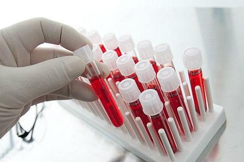 Реферат: Изменение общего анализа крови при разных патологических состояниях